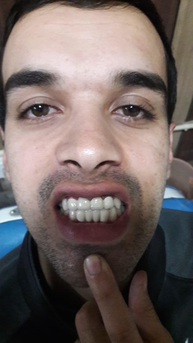 After Case 4